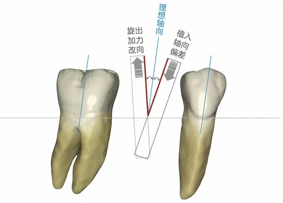axis bisects the angle between the deviation and the applied force axis bisects the angle between the deviation and the applied force