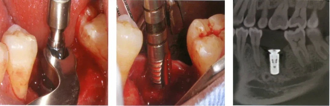 use a fixed wrench to secure the carrier use a fixed wrench to secure the carrier