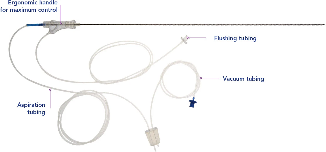 Diagram illustrating the dual-channel design of a double cavity egg retrieval needle with one channel for aspiration and the other for flushing Diagram illustrating the dual-channel design of a double cavity egg retrieval needle with one channel for aspiration and the other for flushing