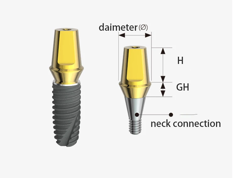 the inner structure of abutment